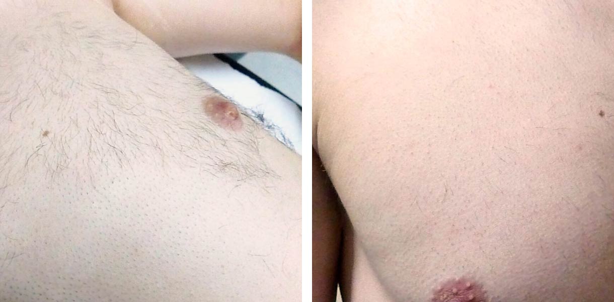 before-after-02